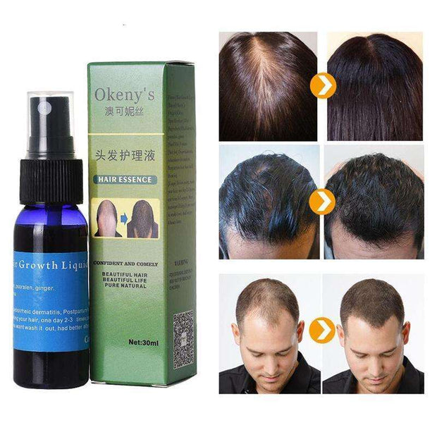 Sunburst Hair Growth Products for women&men anti hair loss products AlOur Hair Growth Serum is a powerful solution for preventing hair loss and promoting solid, strong hair roots. Enriched with ginseng extract, this essence nourishes tkSAAS Merch DesignDesigns by SAASSunburst Hair Growth Products